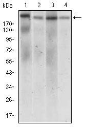 WB - DNMT1 Antibody AO1843a